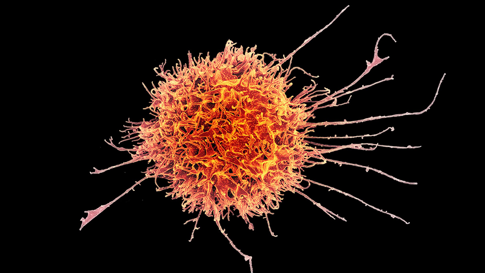 Human immune cells can eliminate cancer cells. Anaveon has developed a special antibody to boost the body’s own defense mechanism. The picture shows an electron-microscopic view of one of the immune system’s CD8 killer cells. (Image: NIAID/flickr)