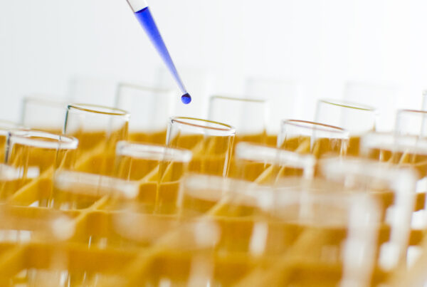 pipette dropping liquid in samples